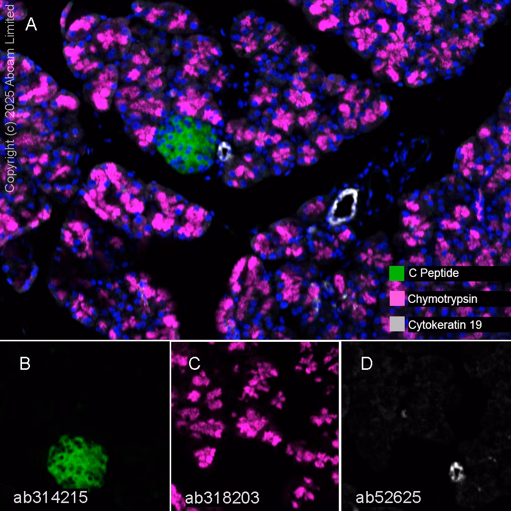 Cytokeratin 19 Antibody Ep1580y Cytoskeleton Marker Ab52625 Multiplex Immunohistochemistry Img447479