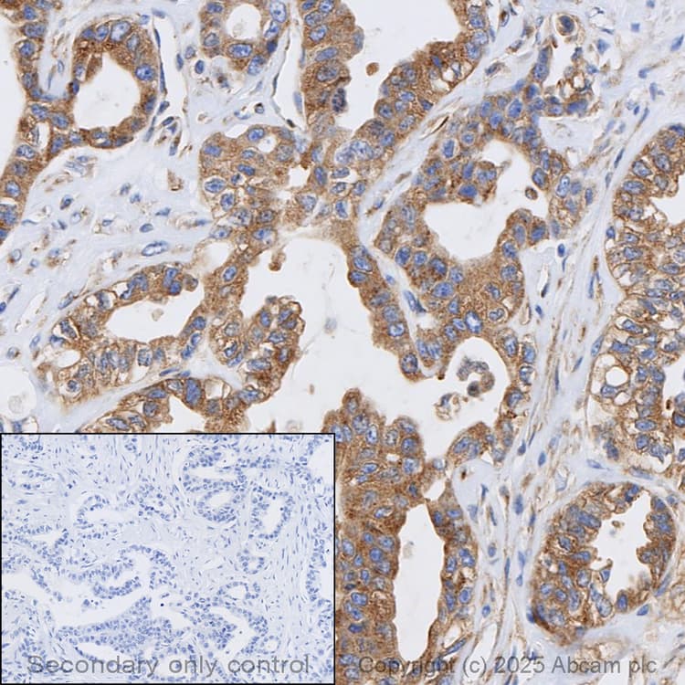Anti-VEGF Receptor 1 antibody [Y103](AB32152)