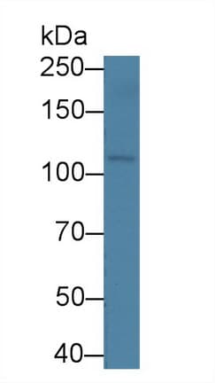 Osmr Antibody Ab232684  Western Blot Img39489