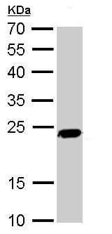 Anti-PGP9.5 antibody(AB227157)