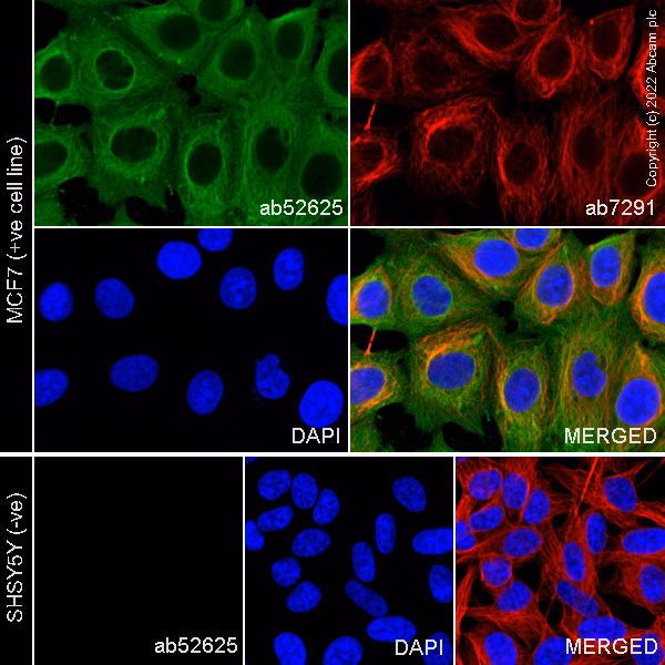 Cytokeratin 19 Antibody Ep1580y Cytoskeleton Marker Ab52625 Immunocytochemistry Immunofluorescence Img400137