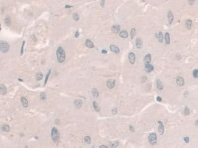 Hemojuvelin Antibody C6 Ab239495  Immunohistochemistry Formalin Pfa Fixed Paraffin Embedded Sections Img108563