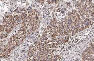 Hck Antibody Hl1673 Ab308234  Immunohistochemistry Paraffin Embedded Sections Img407225