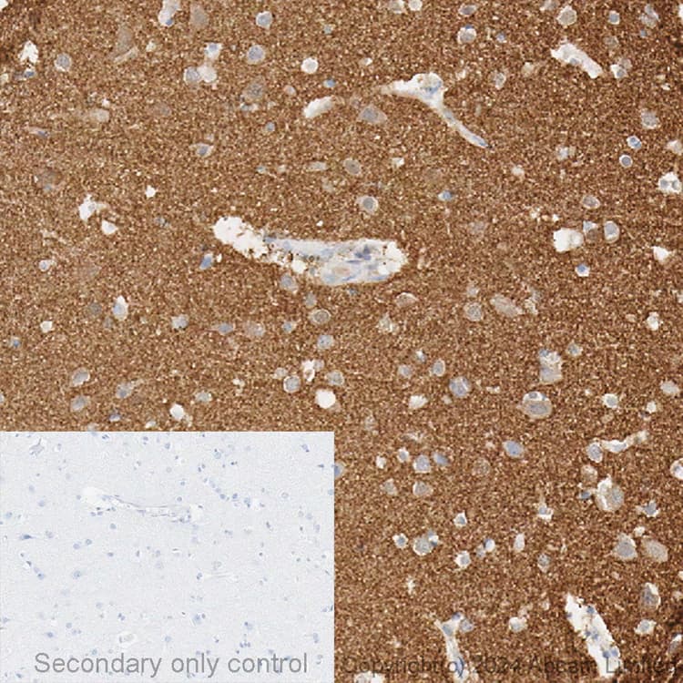 Anti-Alpha-synuclein antibody [MJFR1](AB138501)