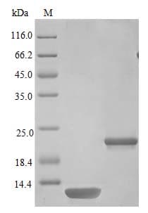 Ab243124  Sds Page Img15798