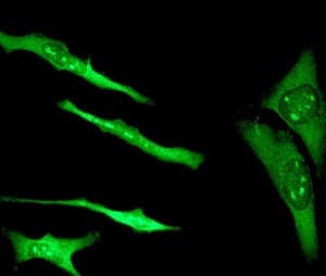 Anti-S100 alpha antibody [EPR5251](AB109384)