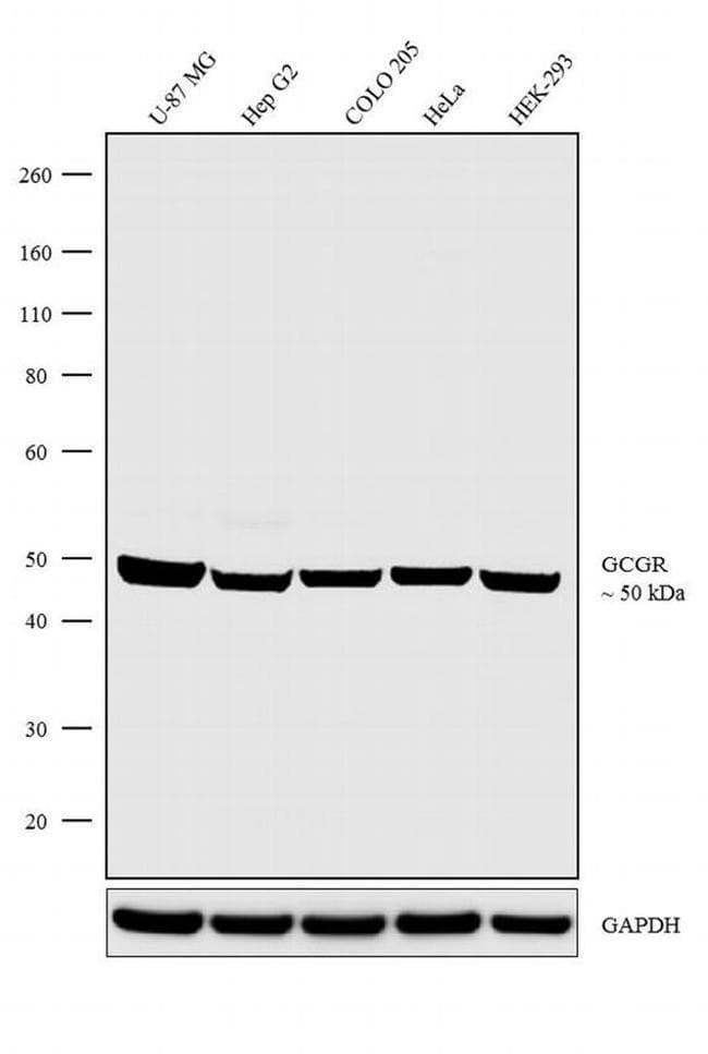 Anti-Glucagon Receptor Antibody [RP23040219](AB313488)