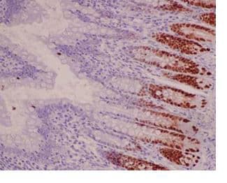 Sox9 Antibody Epr14335 78 Ab185966 Immunohistochemistry Formalin Pfa Fixed Paraffin Embedded Sections Img125255