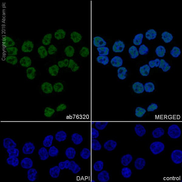 Anti-Cdk9 antibody [EPR3119Y](AB76320)