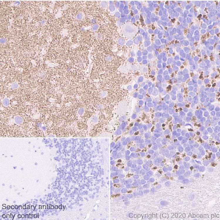 Anti-SYT2 + SYT1 antibody [EPR23920-2](AB259977)