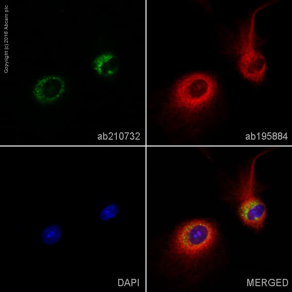 Alexa Fluor 555 Atp Synthase C Antibody Epr13907 Ab210732  Immunocytochemistry Immunofluorescence Img67343