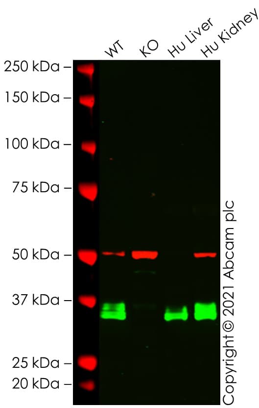 Anti-Apolipoprotein E antibody [EP1374Y](AB52607)