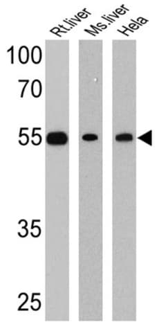 Anti-LXR beta/NER antibody(AB28479)