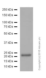 Anti-SOD2/MnSOD (acetyl K68) antibody [EPVANR2](AB137037)