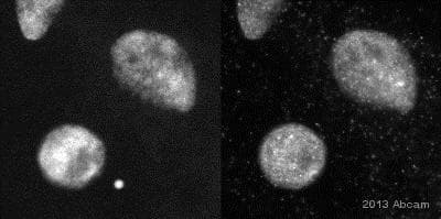 Anti-Sumo 2 + Sumo 3 antibody(AB3742)