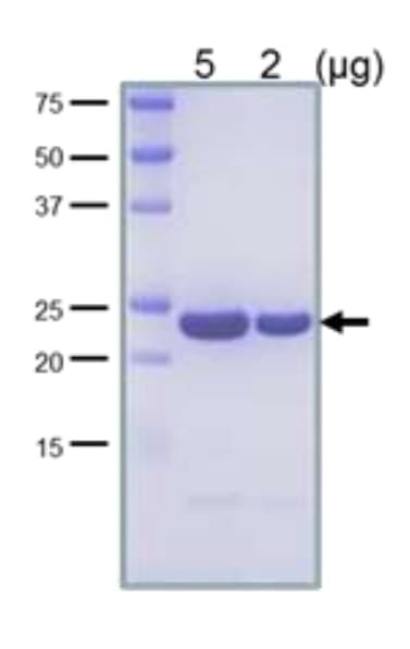 Recombinant E. coli LexA protein(AB63816)