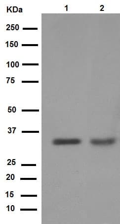 Anti-Cyclin D1 antibody [EPR2241] - C-terminal(AB134175)