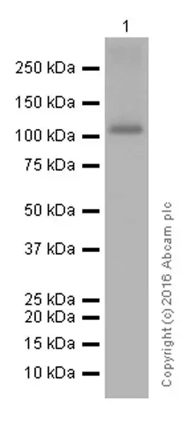 Anti-Androgen Receptor antibody [EPR1535(2)](AB133273)