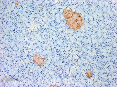 Anti-PGP9.5 antibody [13C4 / I3C4](AB8189)