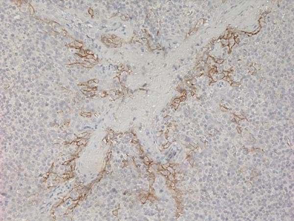 Universal HIER antigen retrieval reagent (10X)(AB208572)