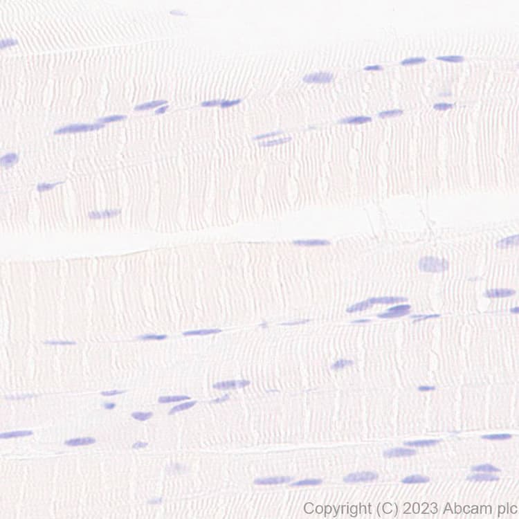 Anti-GABA A Receptor beta 2 antibody [EPR28366-42](AB309540)