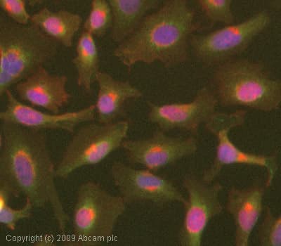 Anti-NFkB Inducing Kinase NIK antibody(AB7204)