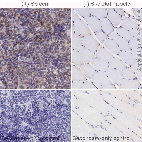 Anti-CD161 antibody [EPR21236](AB234107)