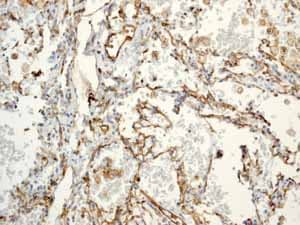 Anti-CD31 antibody [EP3095] - BSA and Azide free(AB226157)