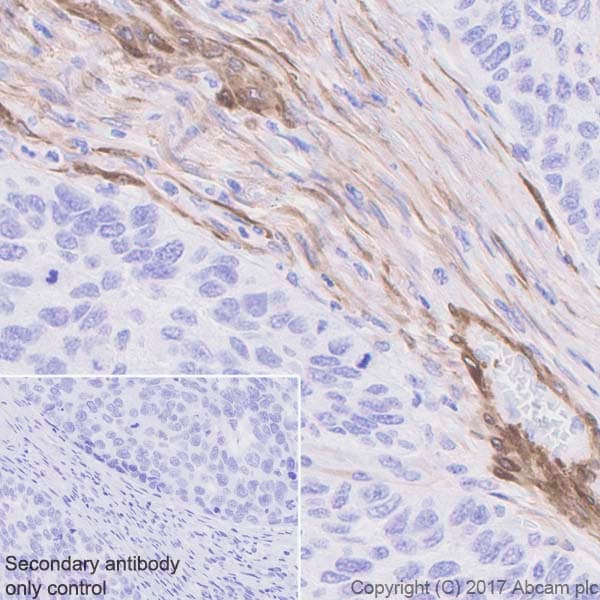 Anti-Calponin 1 antibody [EP798Y](AB46794)