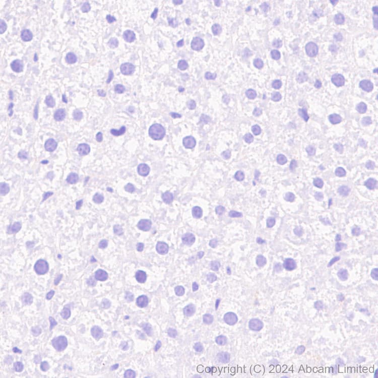 Anti-Tau (MTBR-tau243) antibody [EPR29541-59](AB322554)