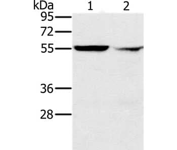Ppm1f Popx2 Antibody Ab200394  Western Blot Img32303