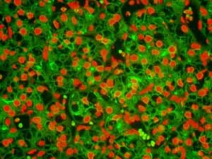Anti-Ezrin antibody [EP886Y] - Plasma Membrane Marker(AB40839)