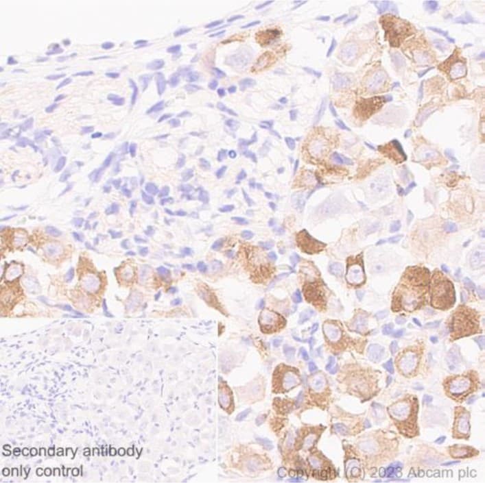 Anti-Nav1.8/SCN10A antibody [S134](AB93616)