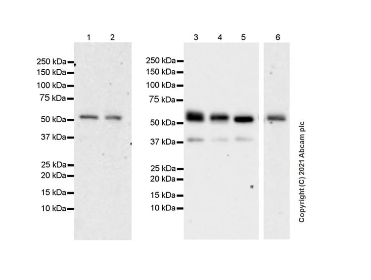 Anti-TGF beta Receptor I antibody [EPR20923-13](AB235578)