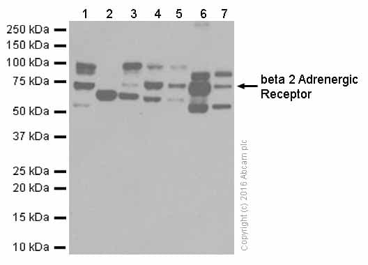 Anti-beta 2 Adrenergic Receptor antibody [EPR707(N)](AB182136)