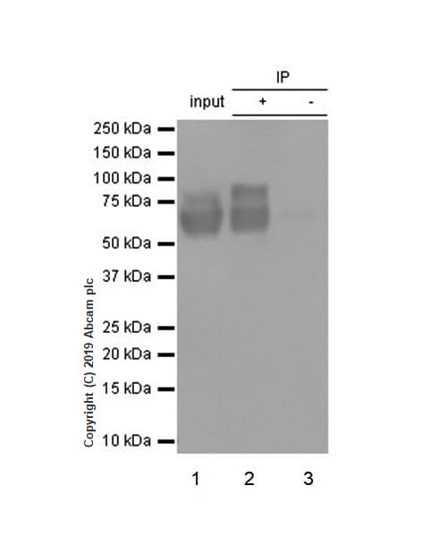 Anti-Choline Acetyltransferase antibody [EPR13024(B)](AB181023)