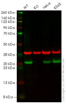 Hmgb2 Antibody Epr6301 Ab124670  Western Blot Img139677