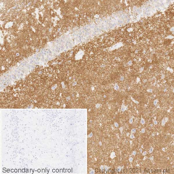 Anti-VGluT1 antibody [EPR22269](ab227805)