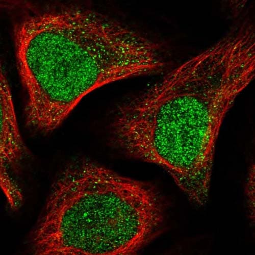 Apc15 Antibody Ab122349  Immunocytochemistry Immunofluorescence Img101153