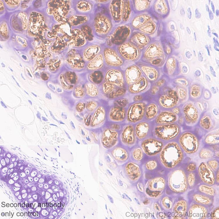 Anti-Aggrecan antibody [EPR28034-86](AB313636)