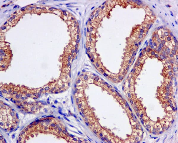 Kbtbd11 Antibody Epr100562b Bsa And Azide Free Ab249501  Immunohistochemistry Formalin Pfa Fixed Paraffin Embedded Sections Img135286