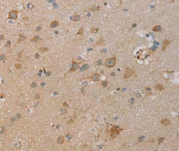 Page2 Antibody Ab198208  Immunohistochemistry Formalin Pfa Fixed Paraffin Embedded Sections Img123515