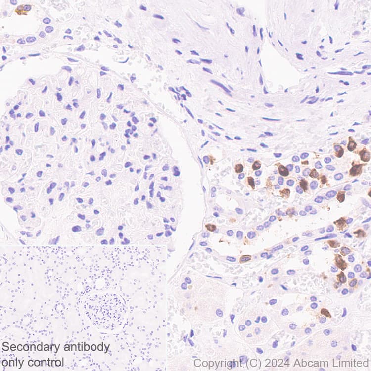 Atp6v0d2 Antibody Epr29173 521 Bsa And Azide Free Ab321810  Immunohistochemistry Formalin Pfa Fixed Paraffin Embedded Sections Img435566