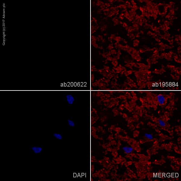 Rabbit Monoclonal H26 10 Human Igg1 H L Alexa Fluor 488 Ab200622  Immunohistochemistry Frozen Sections Img16269