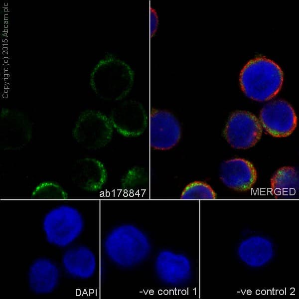 Anti-Iba1 antibody [EPR16589](AB178847)