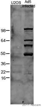 Anti-Adenovirus Type 5 antibody(ab6982)