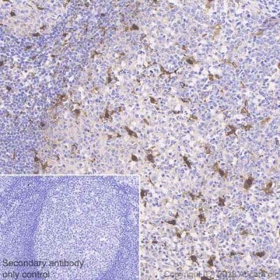 Anti-IL-18 antibody [EPR19954-188](AB243091)