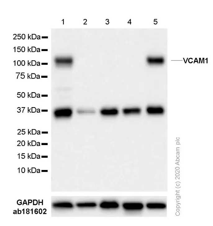 Anti-VCAM1 antibody [EPR5047](AB134047)