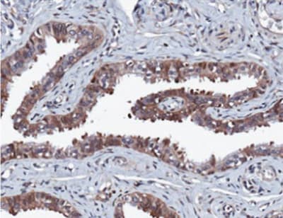 Erk2 Antibody E460 Bsa And Azide Free Ab214170  Immunohistochemistry Formalin Pfa Fixed Paraffin Embedded Sections Img30213