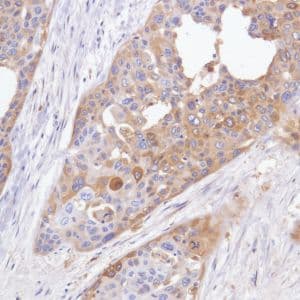 Gpnmb Antibody Sp299 Bsa And Azide Free Ab272016  Immunohistochemistry Formalin Pfa Fixed Paraffin Embedded Sections Img133816